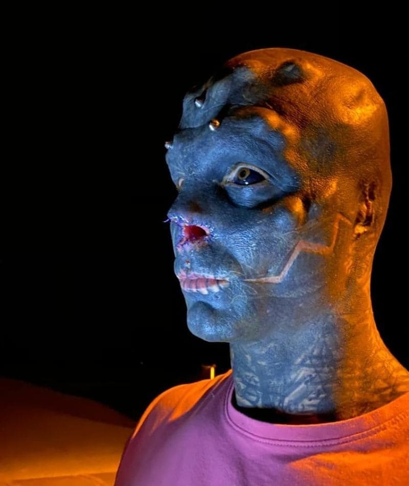 Man transforms himself into black alien by having nose REMOVED
