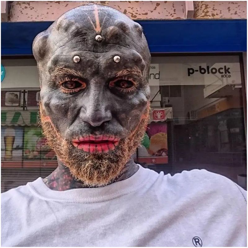 Man transforms himself into black alien by having nose REMOVED