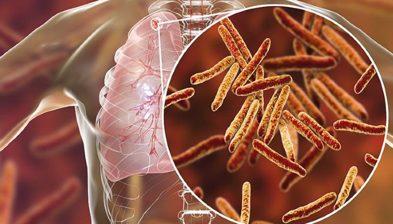 five tips to keep your lungs healthy