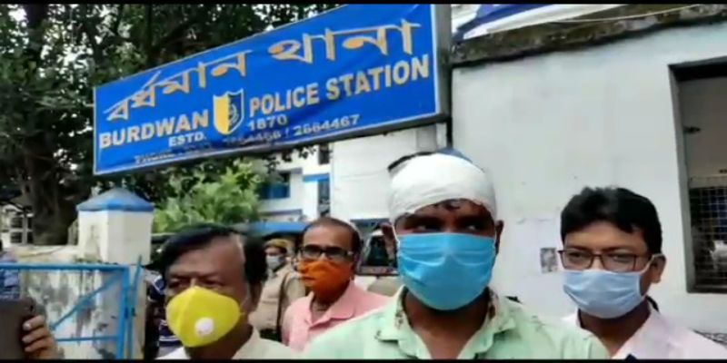 Bjp leader allegedly beaten by TMC ahead of Assembly Election at Burdwan ASB