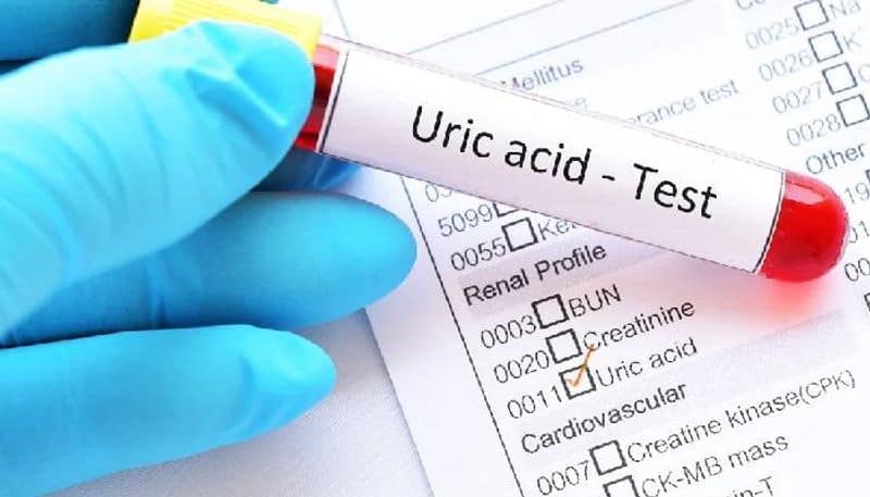what are the uric acid symptoms check out the details BRD
