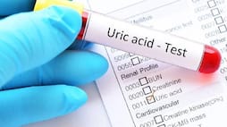 tips to lower your uric acid level naturally rse