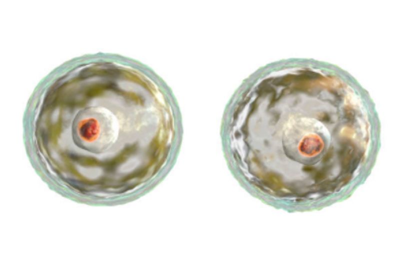 texas on alert after brain eating amoeba kills boy