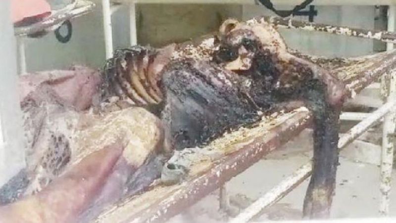 यह मामला भी कुछ दिन पहले इंदौर के ही एमवाय अस्पताल में सामने आया था। यहां मर्च्युरी रूम में 20 दिन शव पड़ा-पड़ा सड़ गया, लेकिन प्रबंधन ने उसके अंतिम संस्कार की सुध नहीं ली। मामला सामने आने के बाद हड़कंप मचा..तब प्रबंधन जागा। आगे पढ़ें...पति की मौत का सदमा: उन्हें तीन दिन से खाना नहीं दिया और न ही कोई इलाज किया