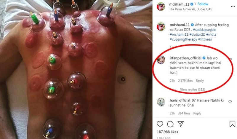 Kings XI Punjab's palyer Mohammed Shami undergoes cupping therapy in Dubai during IPL 2020 spb