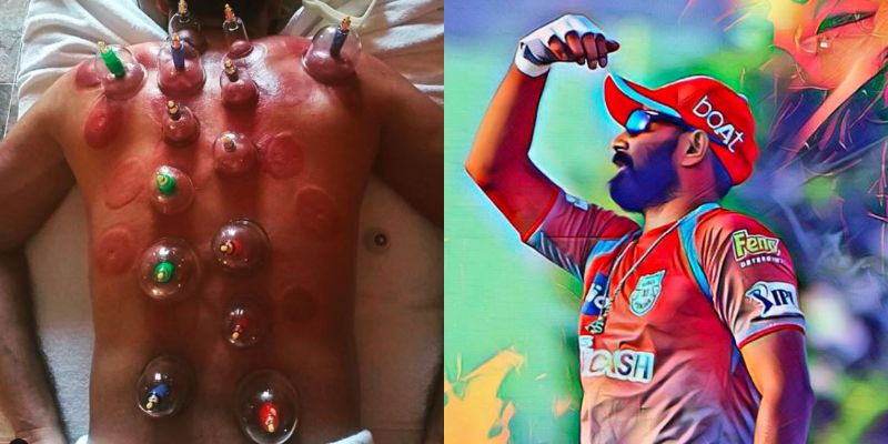 IPL 2020 Reason Behind Dark Spots On KXIP Bowler Mohammed Shami Back As They Leave Fans Confused kvn