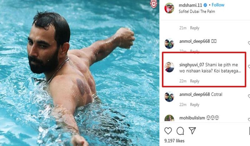 इस फोटो को शेयर करते ही लोगों की नजर उनकी पीठ पर पड़ी। इसमें गोल-गोल निशान नजर आए। ये निशान देख उनके फैंस परेशान हो गए और सवाल करने लगे। 