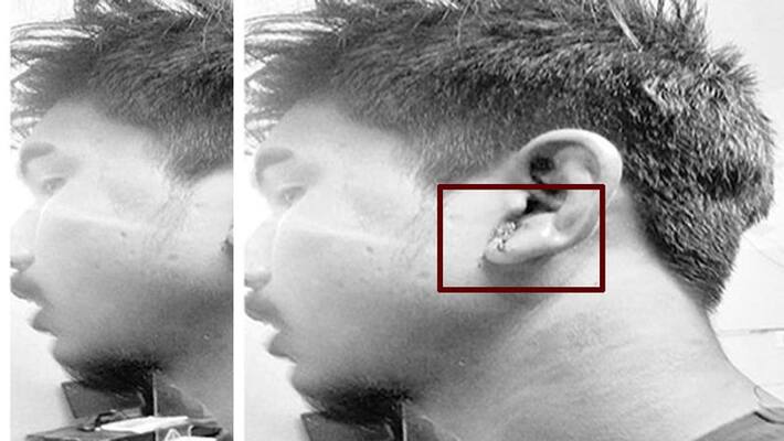 degree student attacked by group of men for not wishing them In rangareddy degree student attacked by group of men for not wishing them In rangareddy