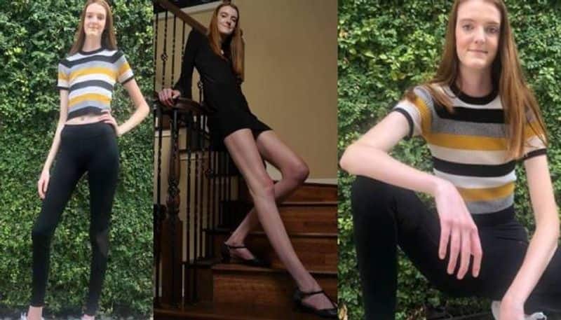 girl breaks Guinness World Record for longest legs