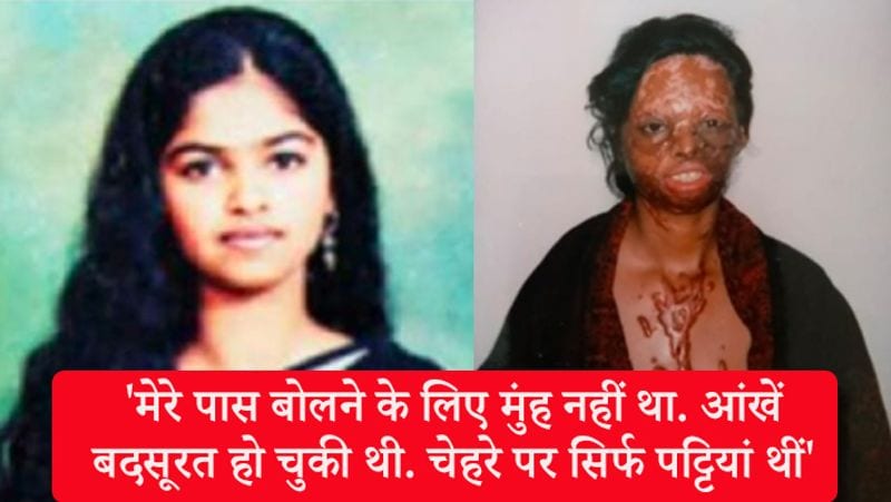 2005 में दिल्ली के खान मार्केट में लक्ष्मी के ऊपर हुए एसिड अटैक ने उनकी जिंदगी बर्बाद कर दी थी। मात्र 15 साल की उम्र में लक्ष्मी ने जो झेला, इंसाफ के लिए कई सालों तक जिस तरह कोर्ट के चक्कर काटे, उसे देख हर कोई उनकी हिम्मत की तारीफ करता है। आज आप को बताते हैं उनकी जिंदगी से जुड़ी ऐसी बातें जिनके बारे में कम ही लोग जानते हैं।
