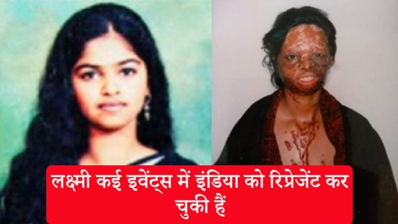 आज लक्ष्मी कई इवेंट्स में इंडिया को रिप्रेसेंट कर चुकी हैं। लेकिन उन्हें आज भी शिकायत है कि उनके पास कोई परमानेंट जॉब नहीं है। साथ ही आज भी वो रेंट वाले घर में रह रही हैं।