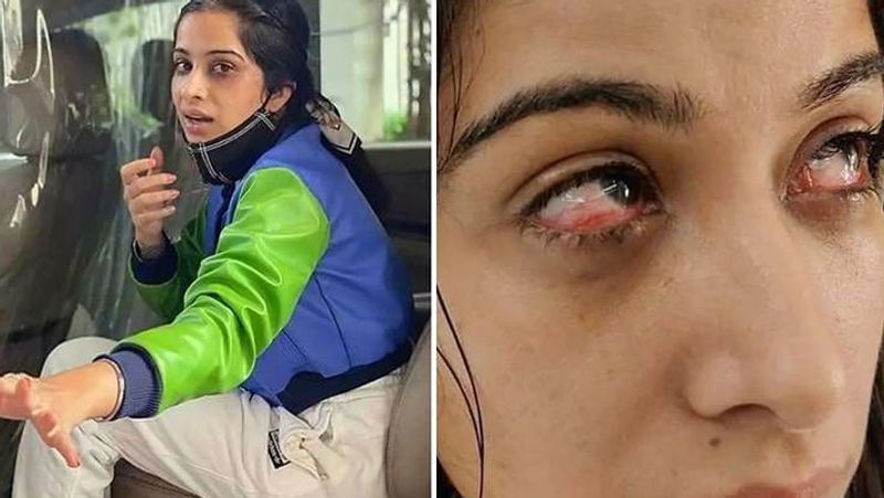 सारा इम्युनिटी टास्क के दौरान बुल्डोजर में बैठी थीं और निक्की उन्हें वहां से उठाने की कोशिश कर रही थीं। इस दौरान निक्की के नाखून जाकर सारा की आंखों में लग गए। बताया जा रहा है कि बिग बॉस 14 के एपिसोड से ये क्लिप एडिट कर निकाल दी गई है। हालांकि, कंटेस्टेंट्स इसके बारे में बात करते दिखे हैं।