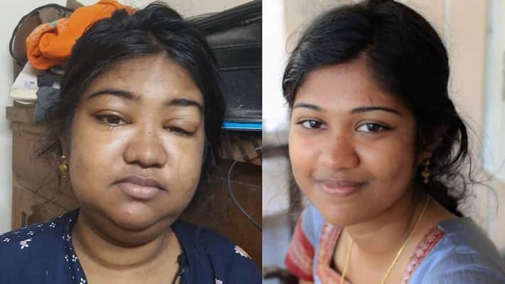 poor family seeks help for kidney transplantation poor family seeks help for kidney transplantation
