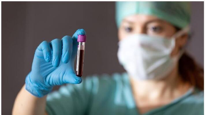 People with blood type O less likely to contract virus study People with blood type O less likely to contract virus study