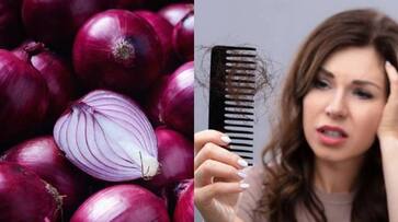 onion juice for hairfall and dandruff onion juice for hairfall and dandruff