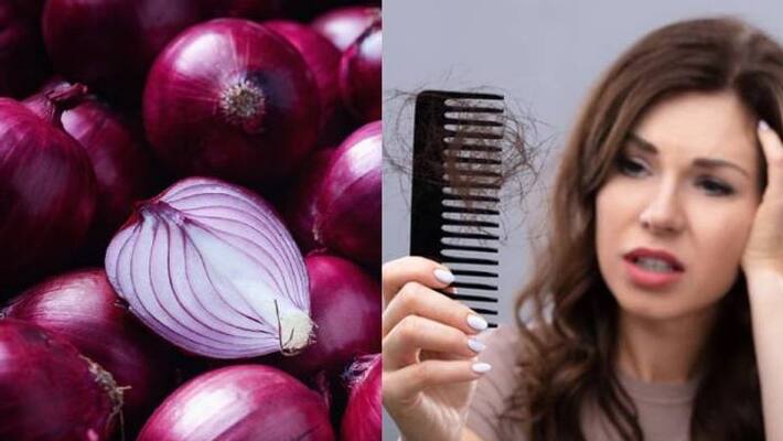 How to use onion juice for treating hair problems How to use onion juice for treating hair problems