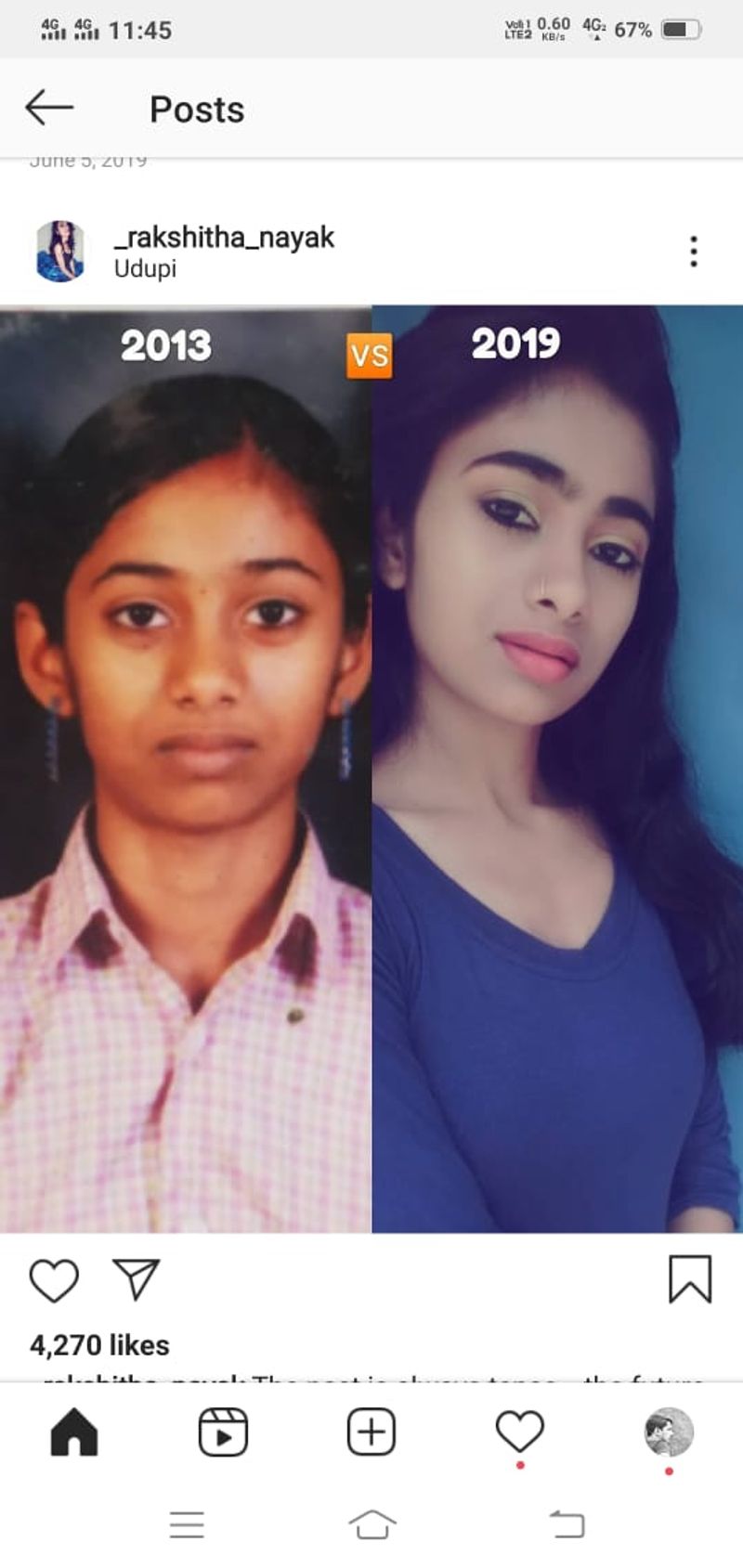 Girl Dies After Admitted To Hospital in Udupi snr