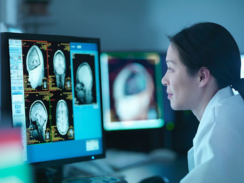 Covid 19 could cost some patients' brains to age 10 years ALB