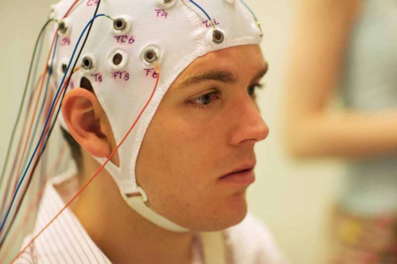 Covid 19 could cost some patients' brains to age 10 years ALB