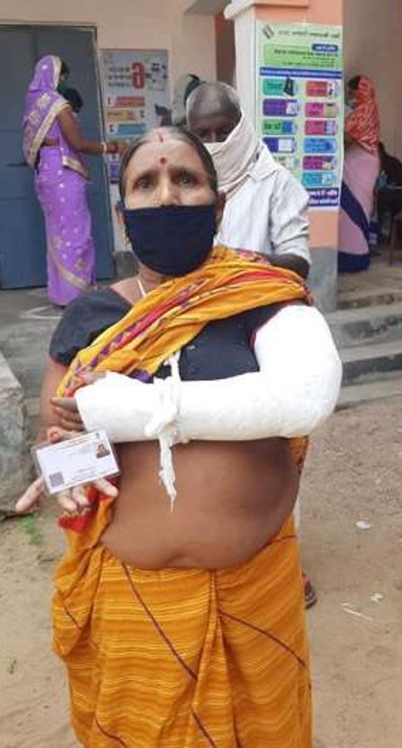 बिहार में मतदान को लेकर उत्साह भी देखने को मिल रहा है। ये महिला हाथ में प्लास्टर लगने के बाद भी मतदान करने पहुंची।