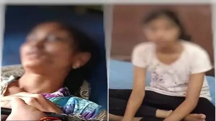 Husband attack wife with acid in Visakhapatnam Husband attack wife with acid in Visakhapatnam