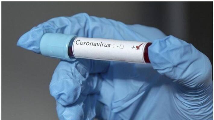 Dont take corona virus lightly Some things to know Dont take corona virus lightly Some things to know