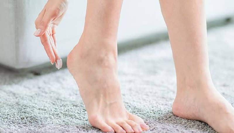 How to heal cracked heels during winter with home remedies