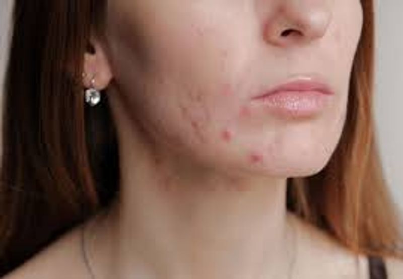 Follow these simple steps at home to get flawless skin-dnm