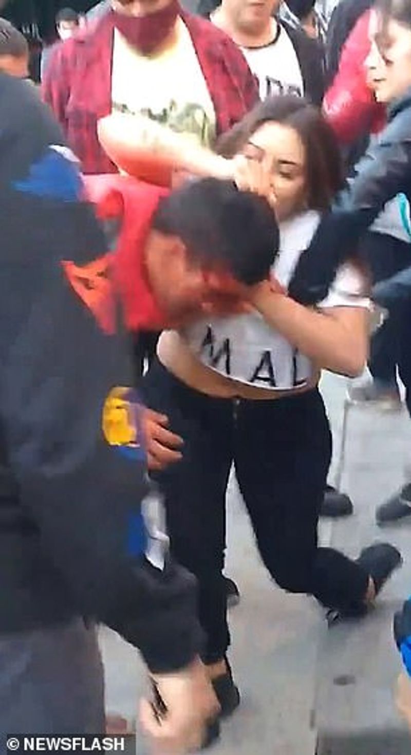 MMA fighter leaves thief with bloodied face