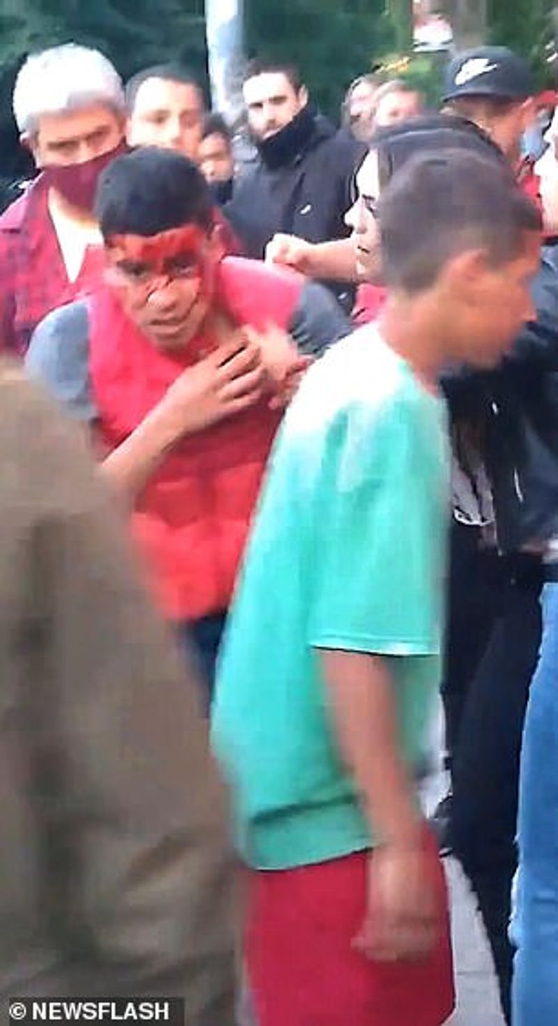 MMA fighter leaves thief with bloodied face