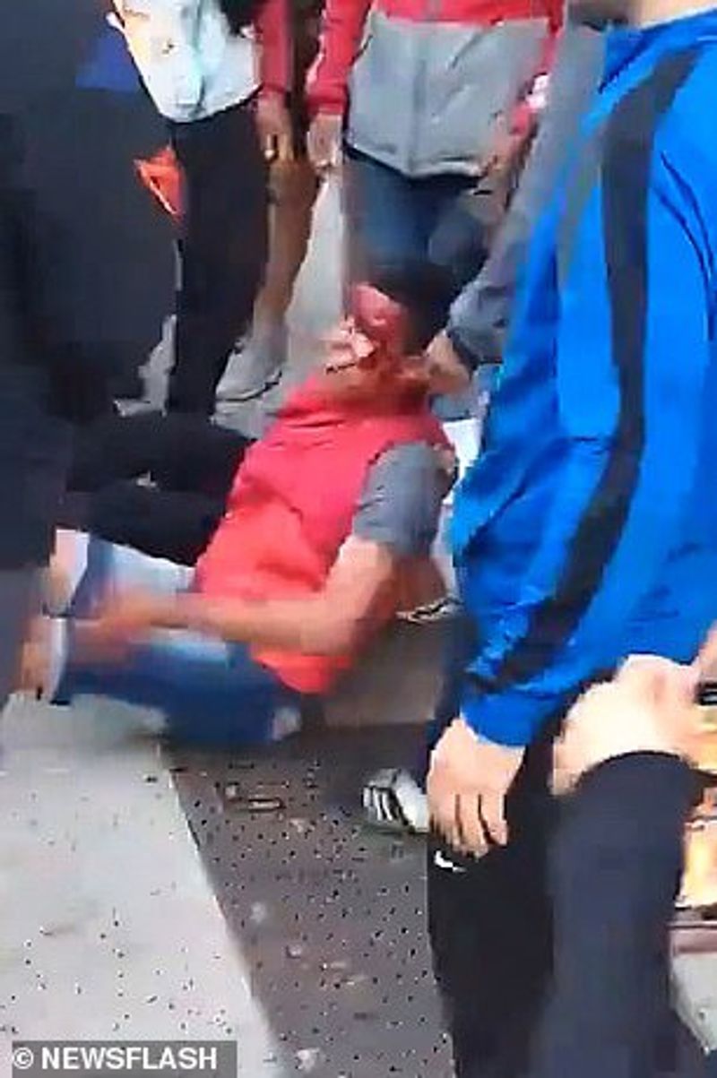 MMA fighter leaves thief with bloodied face