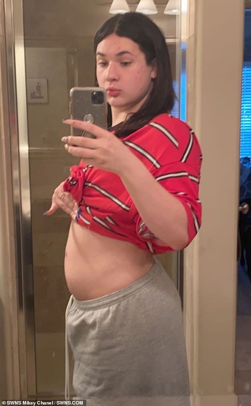 Transgender teenager who was born with male genitalia and raised as a boy is now four months pregnant