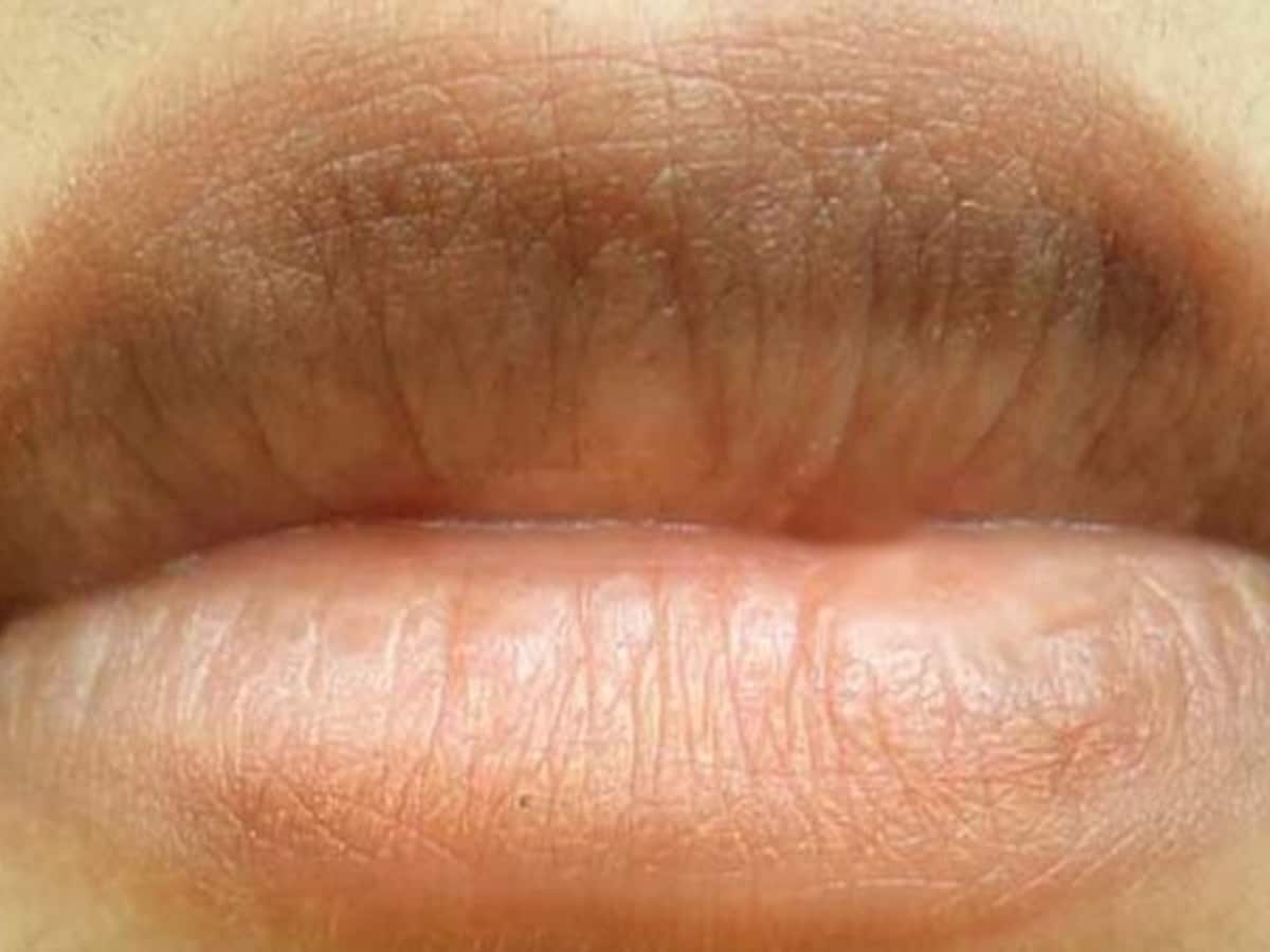 Why Would Lips Turn Black
