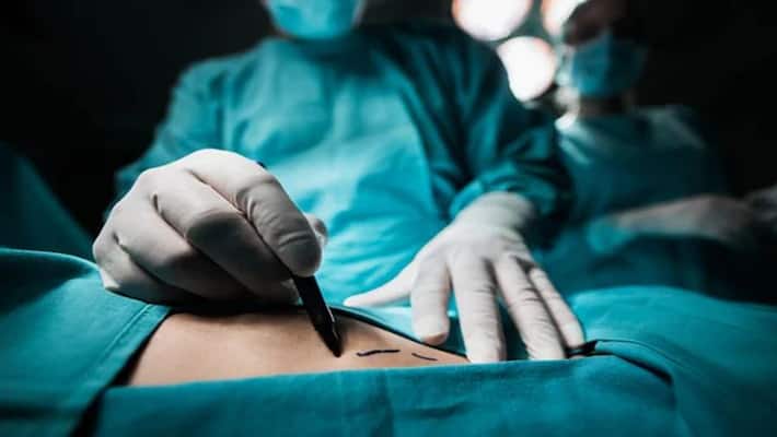 Doctors remove lump of hair weighing around 2kg from teenage girl's stomach in Lucknow Doctors remove lump of hair weighing around 2kg from teenage girl's stomach in Lucknow