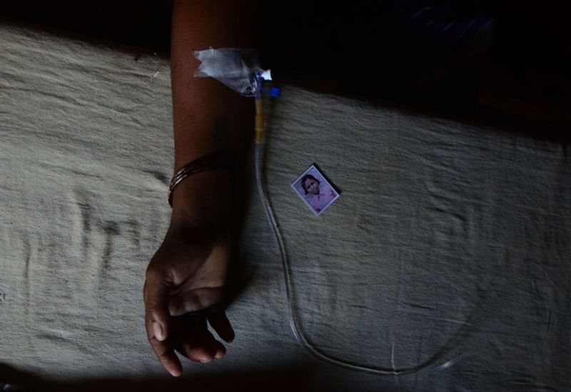 What is Guillain Barre Syndrome, that 24 Covid patients in Mumbai developed ALB