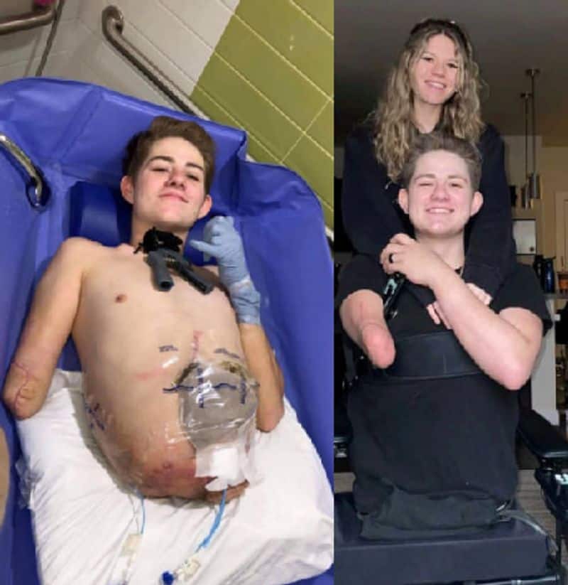 Teenager Chooses To Amputate Bottom Half Of Body To Save His Life dpl