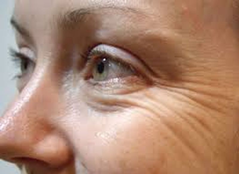 May Slow Down Skin Ageing: There is some evidence to suggest that topical application of green tea extracts along with consumption of the tea may help improve skin elasticity, and hence, slow down skin ageing. Green tea is also known to have a moisturising effect on the skin and it may also reverse sun damage on the skin.