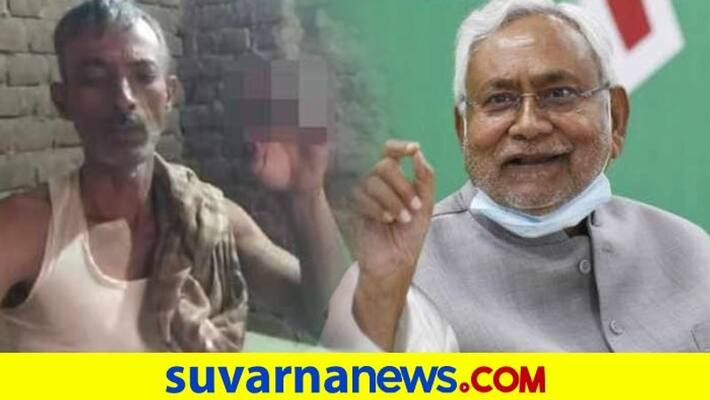 Fan sacrifices another finger his fourth to mark Nitish win in Bihar dpl Fan sacrifices another finger his fourth to mark Nitish win in Bihar dpl