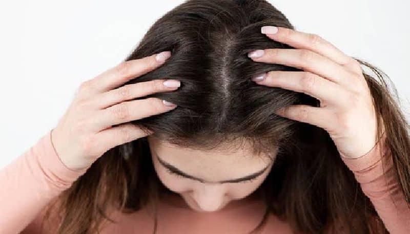 reasons behind dandruff and some solutions too