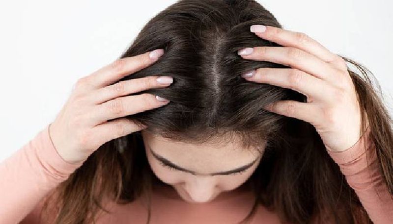 reasons behind dandruff and some solutions too