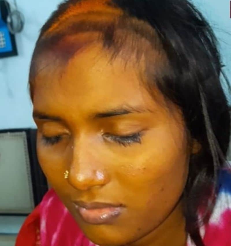 पुलिस ने मौके पर पहुंचकर युवती को हिरासत में ले लिया।वहीं, दुल्हन को इलाज के लिए अस्पताल में भेज दिया गया।
