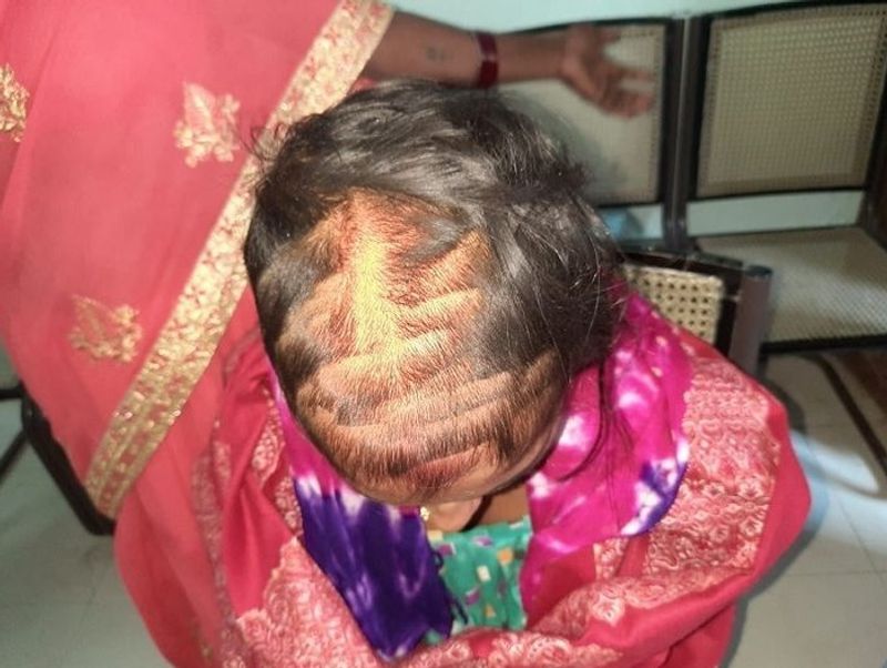 शादी से थके-हारे परिजन जब सो गए, तब देर रात प्रेमिका दुल्हन के रूम में घुस गई और उसके बाल काट डाले। इतना ही नहीं बौखलाहट में उसने दुल्हन की आंख में फेविक्वक भी डाल दिया।