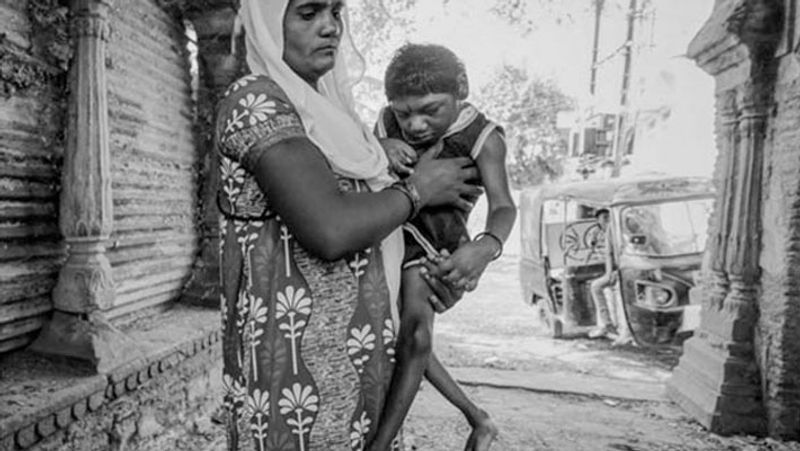 गैस के असर से बच्चे विकलांग पैदा होने लगे।