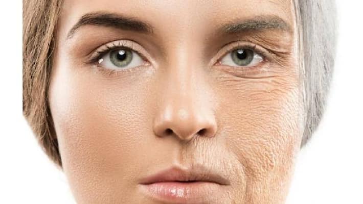 wrinkles and lines in skin may caused by refined sugar from your foods wrinkles and lines in skin may caused by refined sugar from your foods