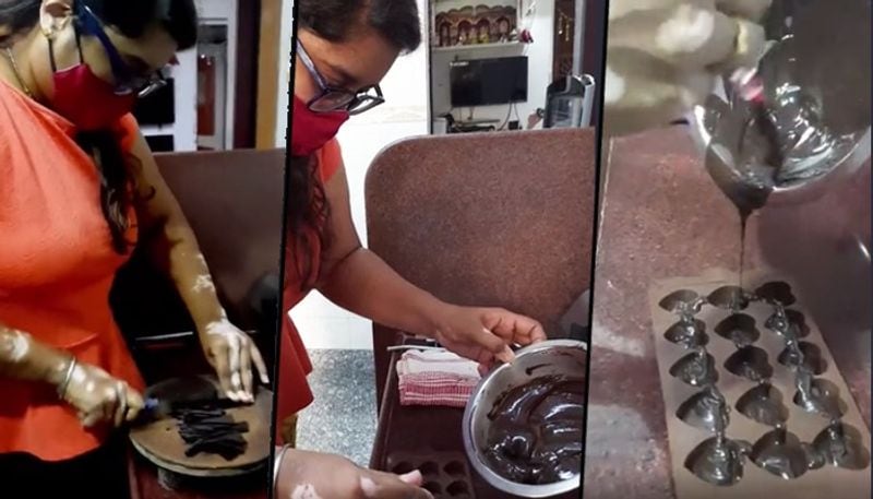 Symbol of determination: 26-yr-old takes on society over leucoderma, establishes herself in chocolate business