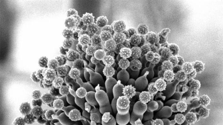 Maharashtra government declares Mucormycosis or black fungus as notified disease-dnm Maharashtra government declares Mucormycosis or black fungus as notified disease-dnm