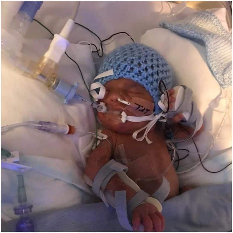 Baby who survived five cardiac arrests returns home to celebrate his first Christmas