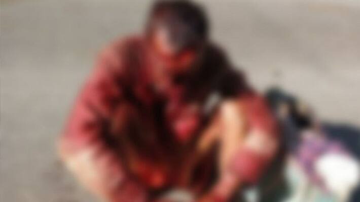 chhattisgarh news bear attack elderly man eats mouth in gaurela-pendra marwahi kpr chhattisgarh news bear attack elderly man eats mouth in gaurela-pendra marwahi kpr