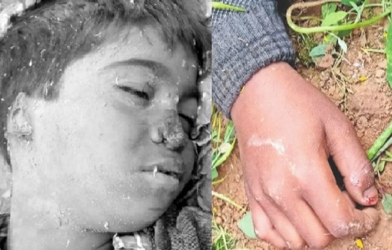 आरोपी कई बार उसके परिवार का नाश करने की धमकी दे चुके। इसके चलते करीब 7 दिन पहले भी रघुवीर ने पुलिस को शिकायत दी थी। तब पुलिस उनके यहां पहुंची भी थी। लेकिन, इसके बाद भी इन लोगों का पाखंड जारी था। फिलहाल, पुलिस आरोपों के आधार पर कार्रवाई में जुट हुई है।