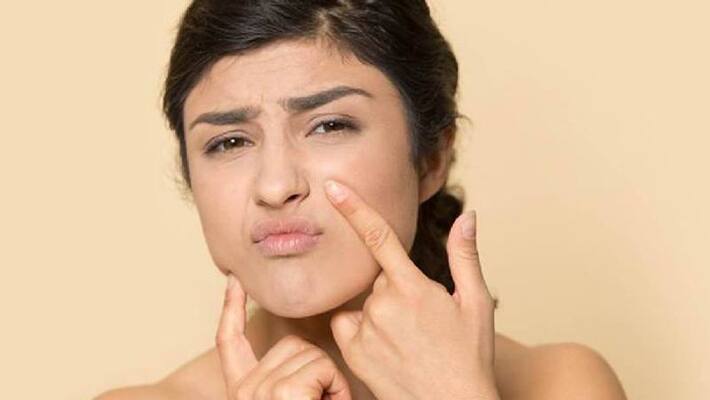five home remedies to prevent dry skin during winter five home remedies to prevent dry skin during winter